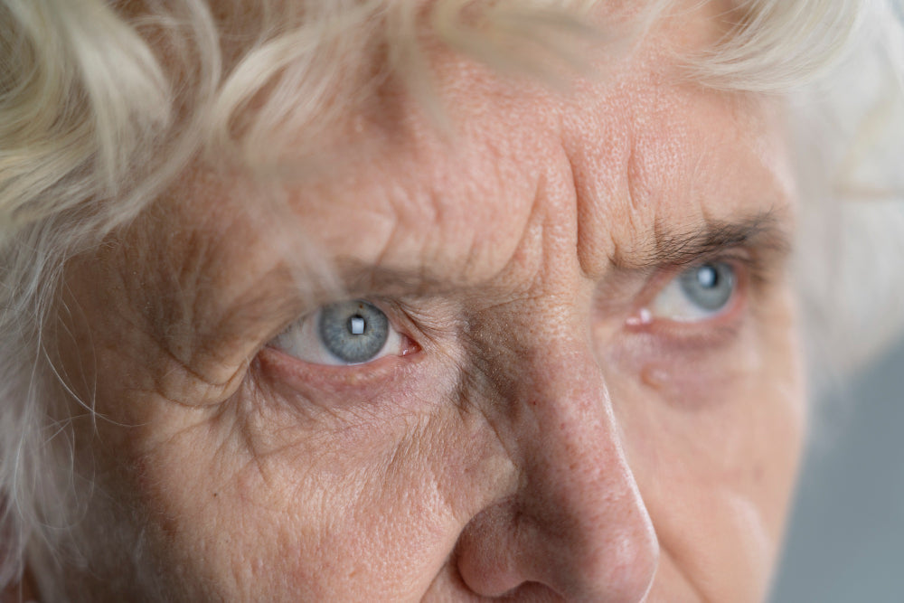Age Related Macular Degenration (AMD)